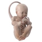 Neonatology